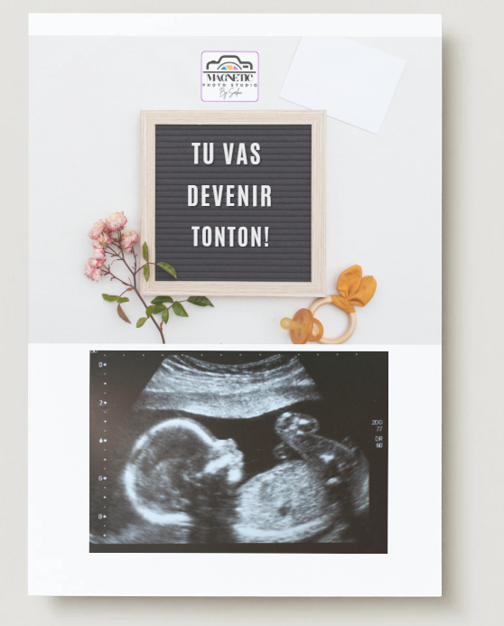 Carte Annonce Grossesse Magnet photo écho